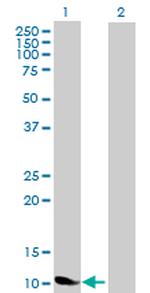 NDP Antibody in Western Blot (WB)