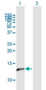 NDUFA5 Antibody in Western Blot (WB)