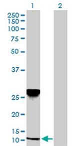 NDUFA5 Antibody in Western Blot (WB)