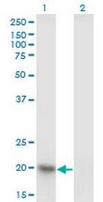 NDUFAB1 Antibody in Western Blot (WB)