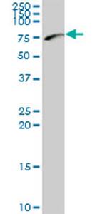 NEFL Antibody in Western Blot (WB)