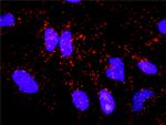 NEFL Antibody in Proximity Ligation Assay (PLA) (PLA)