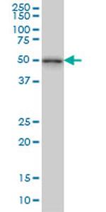 NEK2 Antibody in Western Blot (WB)