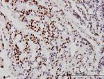 NEUROD1 Antibody in Immunohistochemistry (Paraffin) (IHC (P))