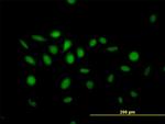 NFIX Antibody in Immunocytochemistry (ICC/IF)