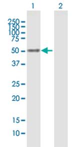 NFIX Antibody in Western Blot (WB)