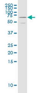 NFIX Antibody in Western Blot (WB)