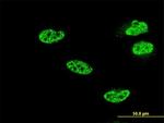 NFKB1 Antibody in Immunocytochemistry (ICC/IF)