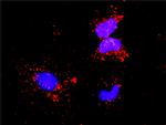 NFKB1 Antibody in Proximity Ligation Assay (PLA) (PLA)