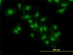 NFKB1 Antibody in Immunocytochemistry (ICC/IF)