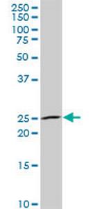 NKX3-1 Antibody in Western Blot (WB)