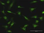 NME1 Antibody in Immunocytochemistry (ICC/IF)