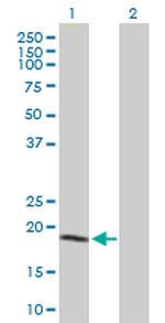 NME1 Antibody in Western Blot (WB)