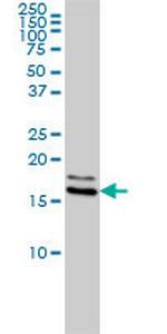 NME1 Antibody in Western Blot (WB)