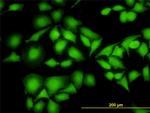 NME1 Antibody in Immunocytochemistry (ICC/IF)