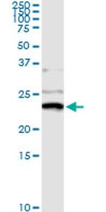 NME1 Antibody in Immunoprecipitation (IP)