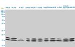 NME1 Antibody in Western Blot (WB)