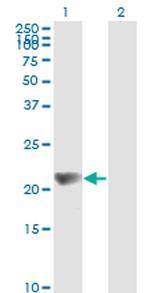 NME1 Antibody in Western Blot (WB)