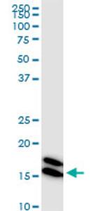 NME1 Antibody in Western Blot (WB)