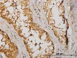 NME2 Antibody in Immunohistochemistry (Paraffin) (IHC (P))