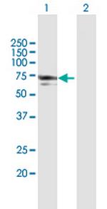 NMT1 Antibody in Western Blot (WB)