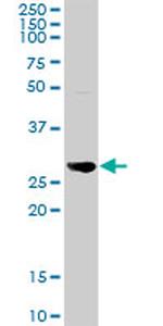 NNMT Antibody in Western Blot (WB)