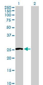 NNMT Antibody in Western Blot (WB)