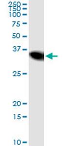 NNMT Antibody in Immunoprecipitation (IP)