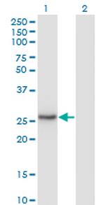 NNMT Antibody in Western Blot (WB)