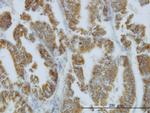 NODAL Antibody in Immunohistochemistry (Paraffin) (IHC (P))