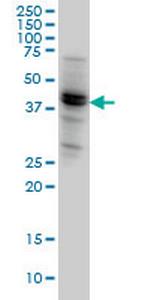 NODAL Antibody in Western Blot (WB)