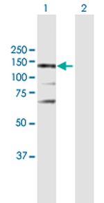 NOS3 Antibody in Western Blot (WB)