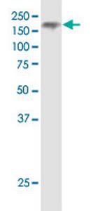 NPC1 Antibody in Western Blot (WB)