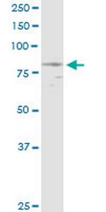 NPHP1 Antibody in Western Blot (WB)