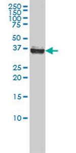 NPM1 Antibody in Western Blot (WB)