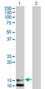 NPPB Antibody in Western Blot (WB)