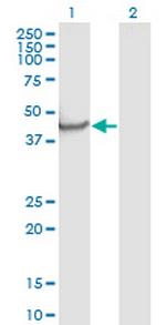 NPTX1 Antibody in Western Blot (WB)