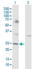 NTF4 Antibody in Western Blot (WB)