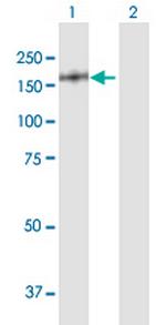 NUMA1 Antibody in Western Blot (WB)