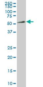 NR4A2 Antibody in Western Blot (WB)