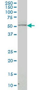 NR4A2 Antibody in Western Blot (WB)