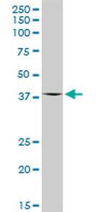 OAS1 Antibody in Western Blot (WB)