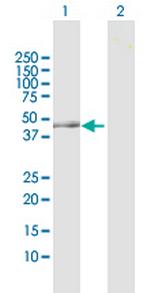 OAT Antibody in Western Blot (WB)