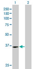 OGN Antibody in Western Blot (WB)