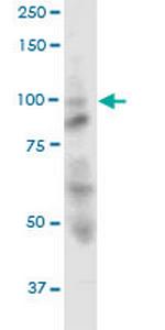 OPA1 Antibody in Western Blot (WB)