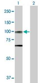 OPA1 Antibody in Western Blot (WB)