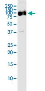 OPA1 Antibody in Western Blot (WB)