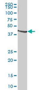 TNFRSF11B Antibody in Western Blot (WB)