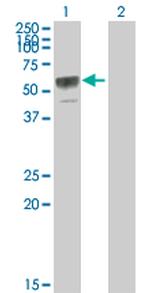 TNFRSF11B Antibody in Western Blot (WB)