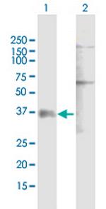 P2RY1 Antibody in Western Blot (WB)